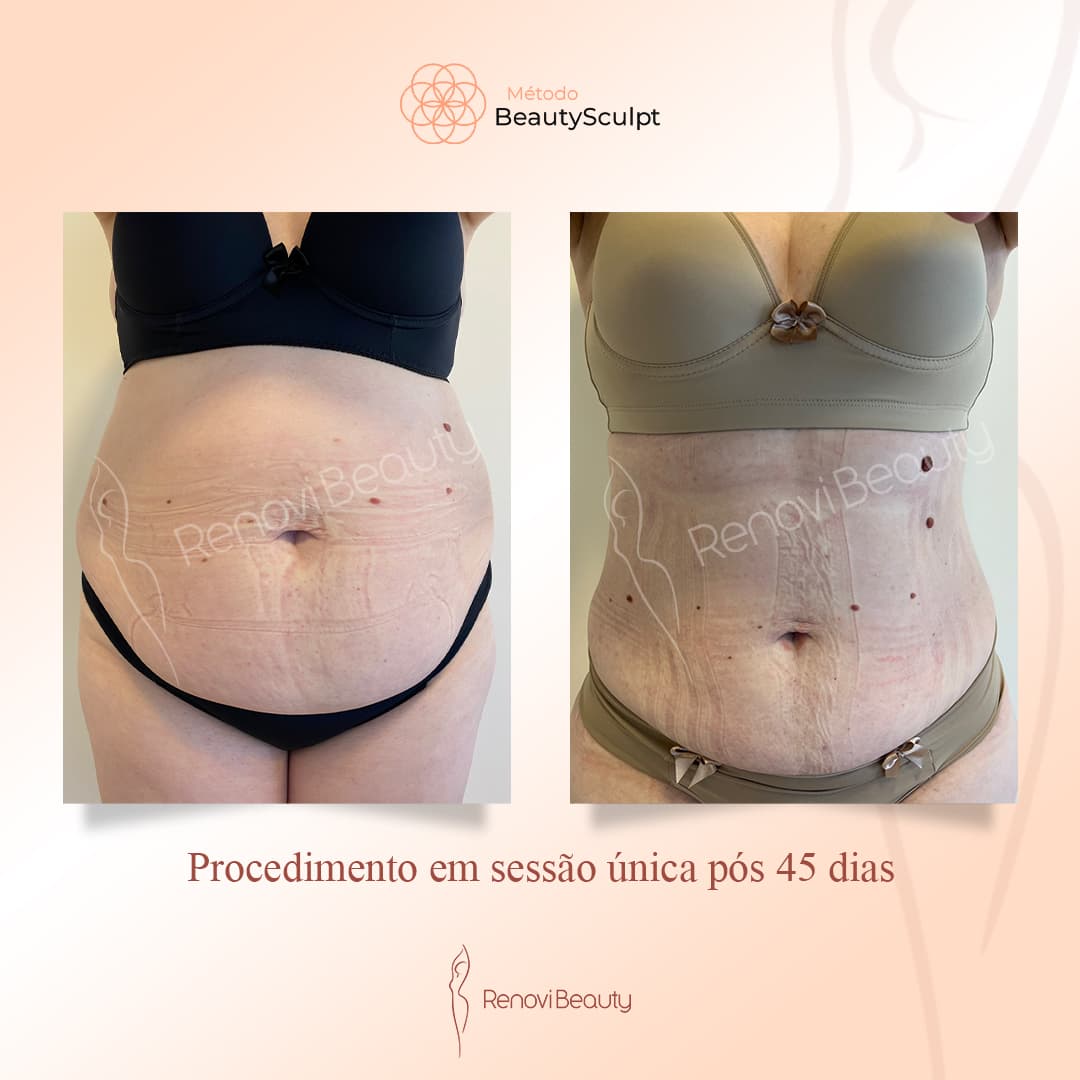 Resultado Comprovado