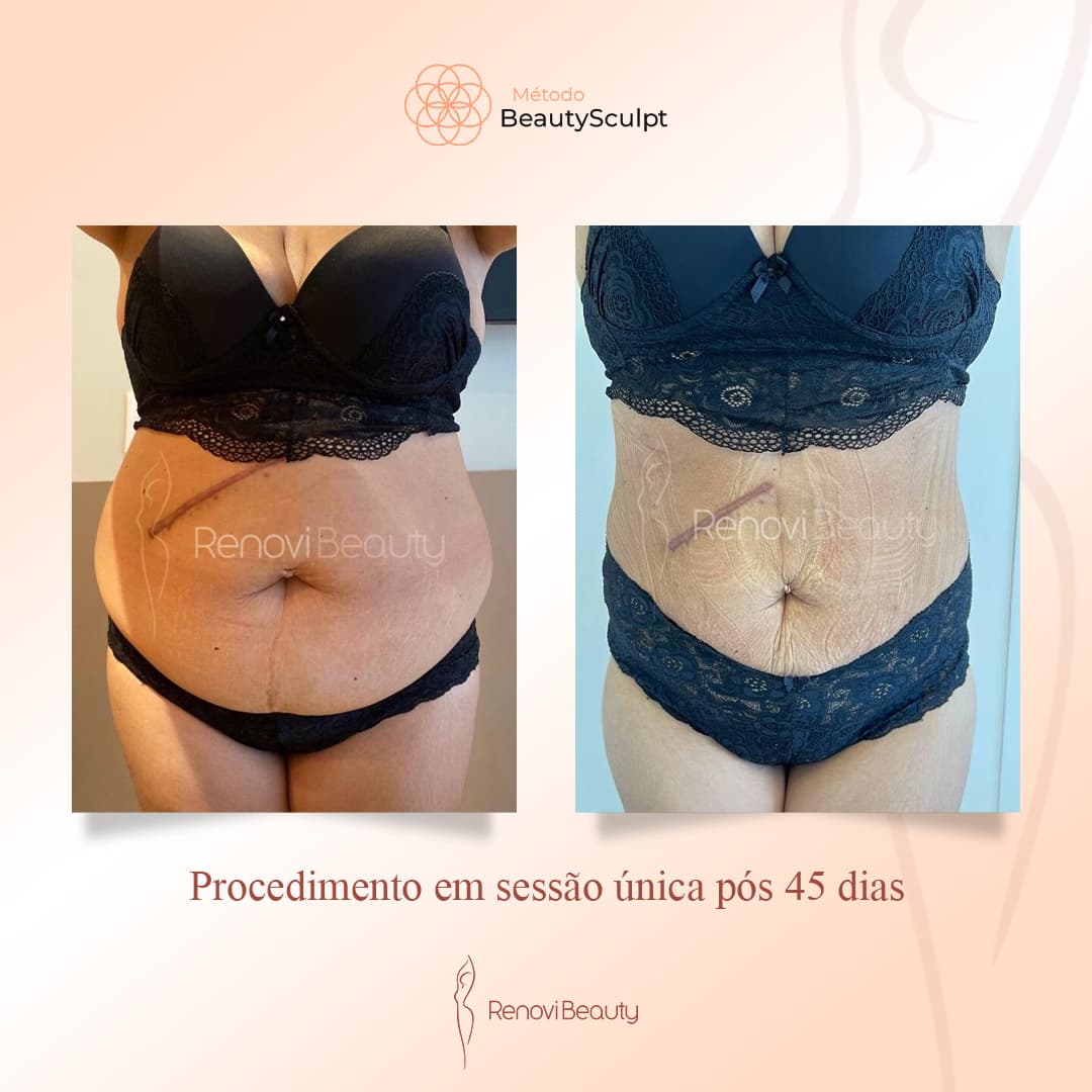 Transformação Completa