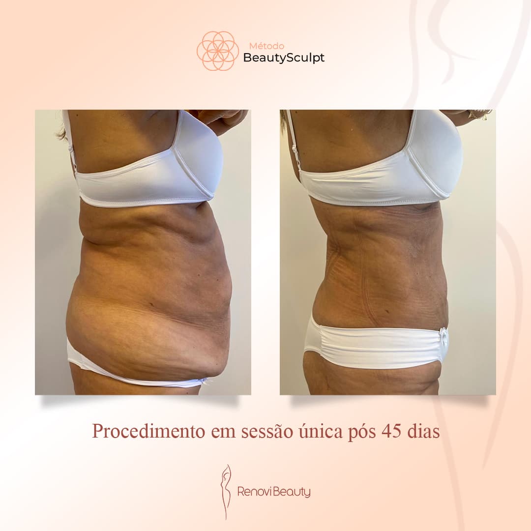 Mudança Significativa