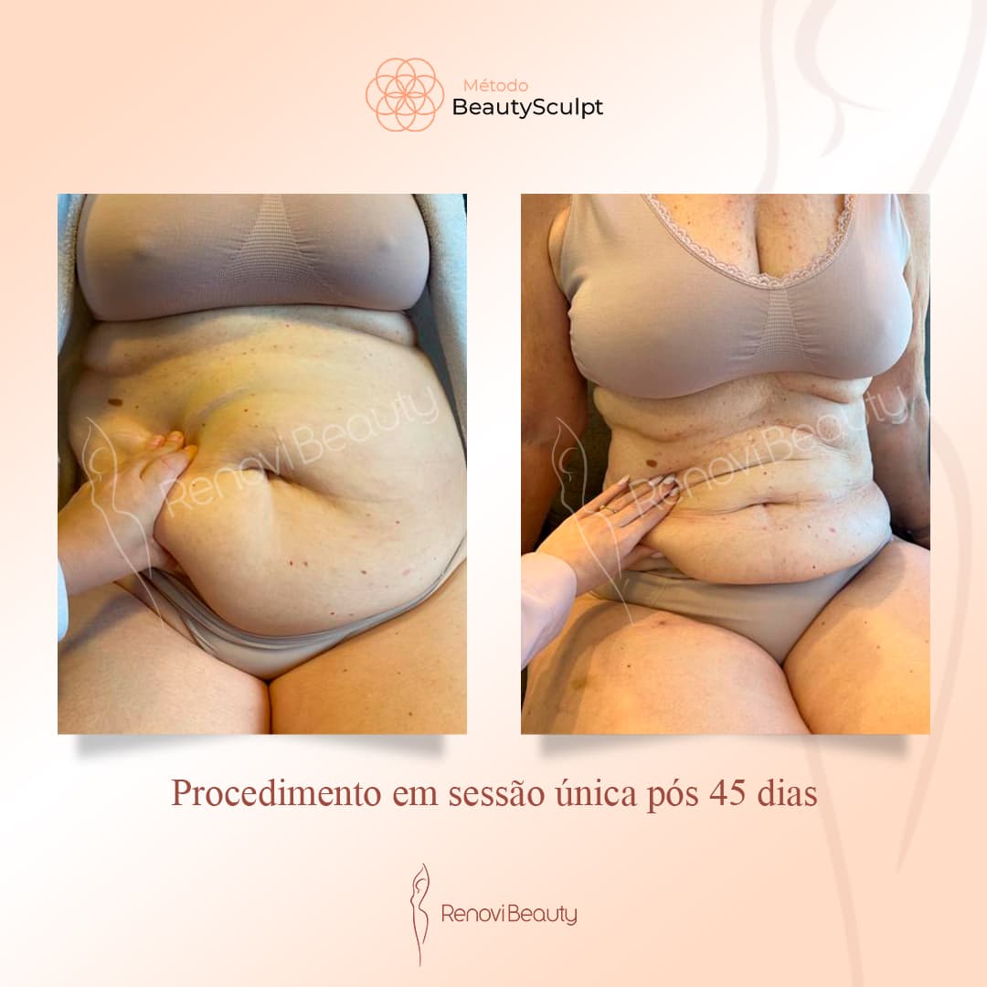 Transformação Real